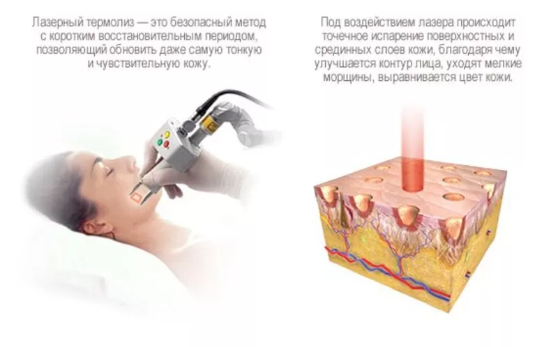 Лазерная клиника Fotona 10