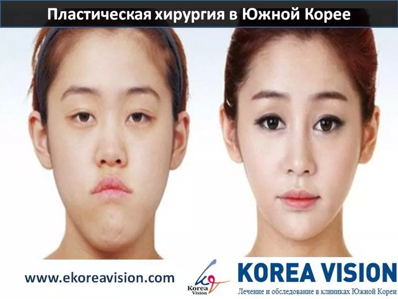  Пластическая хирургия в Южной Корее