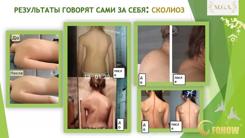  СЕАНС БИОЭНЕРГОМАССАЖА FOHOW. 2